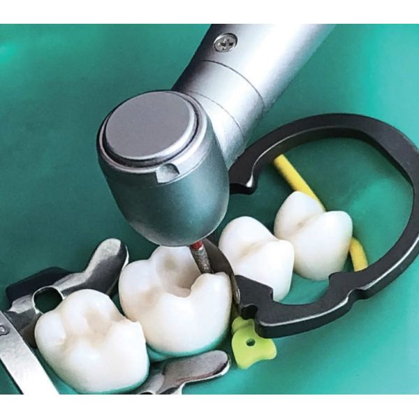 Dental Sectional Matrix System Wedge Guards M3