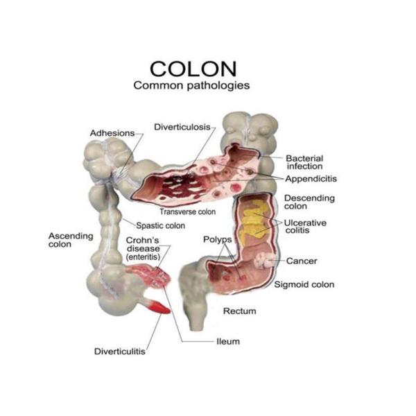 Advanced Medical Human Large Intestine Anatomy Model For School Hospital