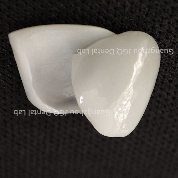 Tooth Like Shells Dental Porcelain Emax Veneers Dsd Design China Dental Lab