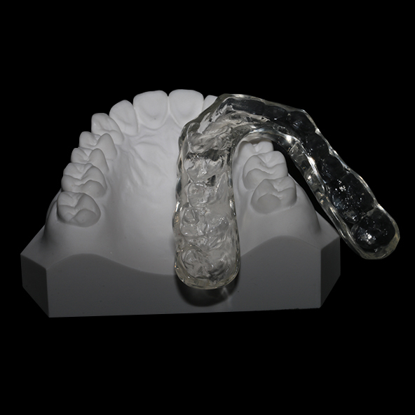 Digital Dental Solutions Lab | Dental Hard Occlusal Splint 1-3mm For Jaw Pain Relief Protection Oral