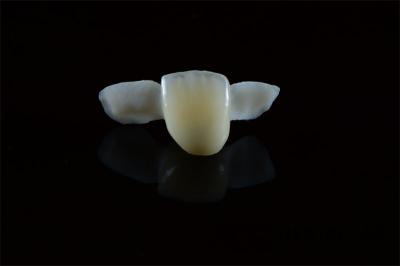 High quality Dental Resin-bonded Maryland bridge from ADS China Dental Lab