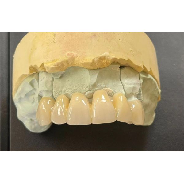 57% Translucency Zirconia Yttria Stabilized Blank 98mm 8 Layers 15 Gradients
