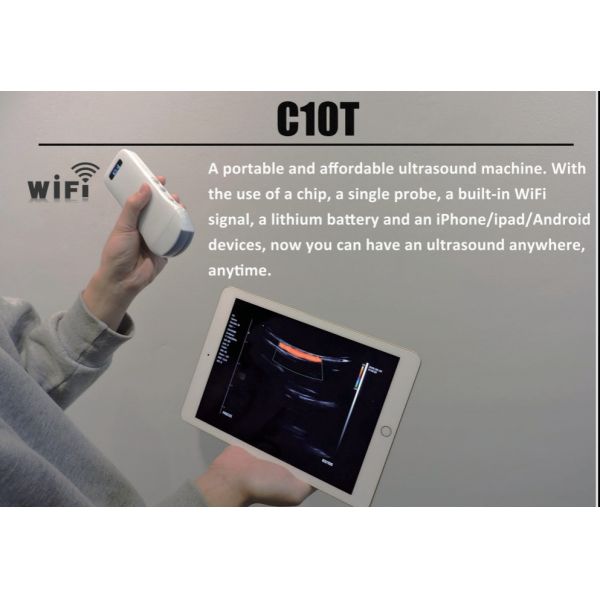 128 Elements Medical Hospital Equipments Color Doppler Portable Wireless Ultrasound Machine 3 In 1