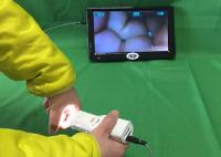 X um Colposcope eletrônico de 1,5 Digitas da ampliação conectam à tevê ou o computador ou monitor médico para saúde de s das mulheres '