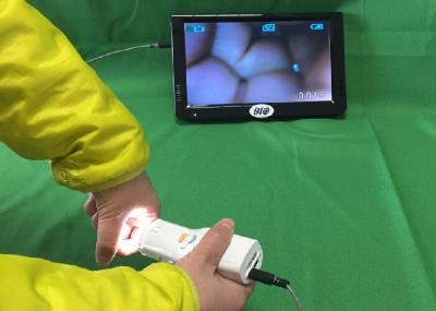 X um Colposcope eletrônico de 1,5 Digitas da ampliação conectam à tevê ou o computador ou monitor médico para saúde de s das mulheres '