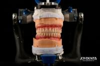 Lightweight Comfortable Fit Acrylic Dental Denture Finish Professional Personalization