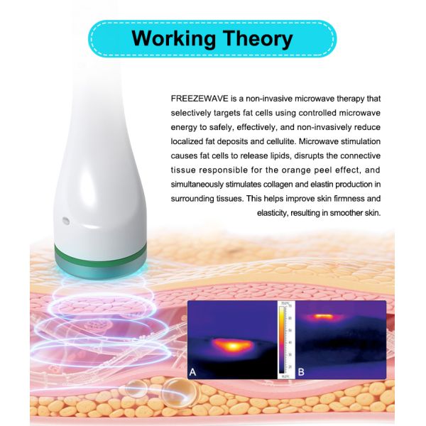 Newest Coolwaves Body Shaping Machine for Cellulite Fat Loss