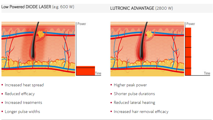 ODM 808nm Laser Hair Removal Machine Optimized Pulsed Technology