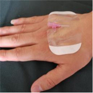 пусковые площадки 5*6cm водоустойчивые прозрачные одевая стерильные слипчивые для ран