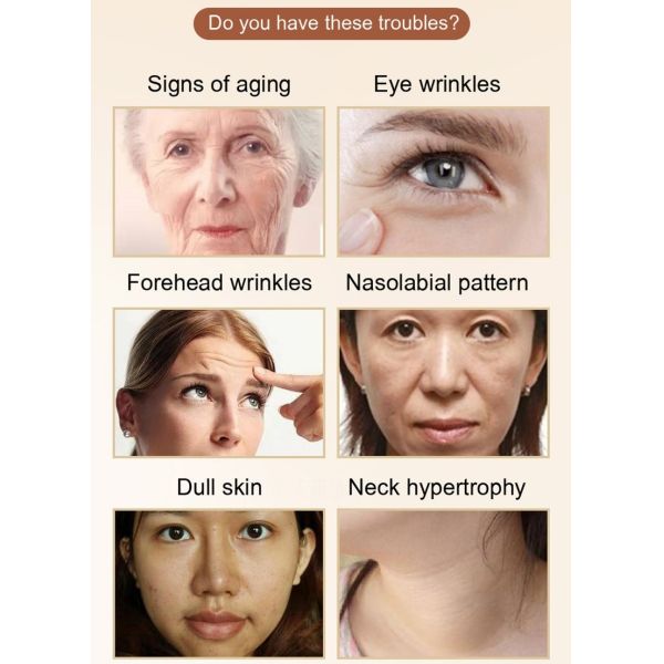 Сторона машины красоты Hifu ультразвука Rf личная затягивая анти- морщинку