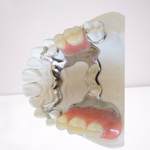 FDA PFM Dental Bridge Good Biocompatibility 3D Printing Dental Models