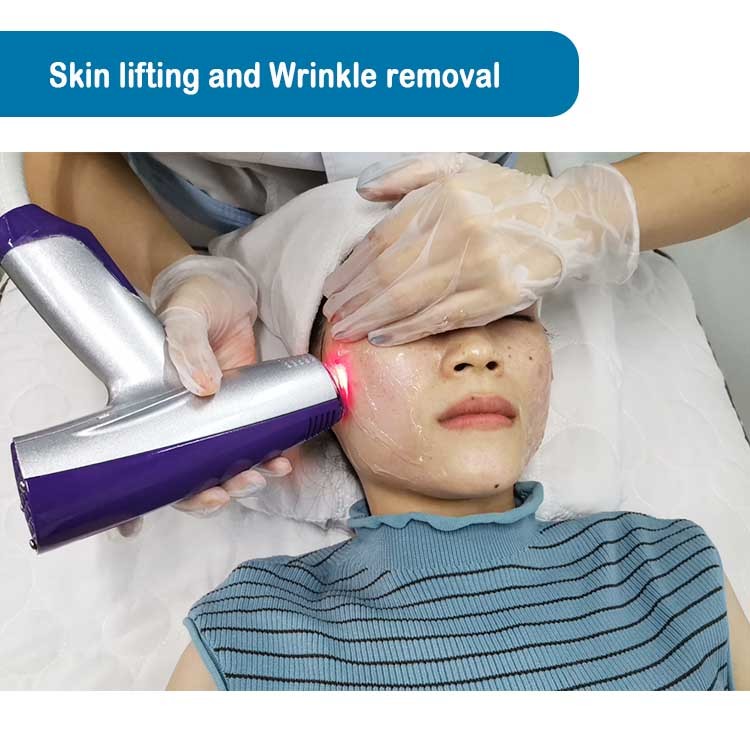 Rf Power Microneedling Fractional Rf Microneedle Scarlet Устройство с вакуумом