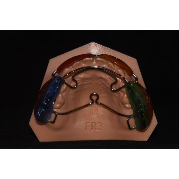 Frankel Ⅲ Malocclusion Orthodontic Functional Appliance Professional