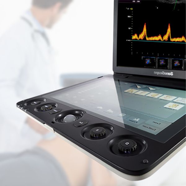 Sonoscape S9 Pregnant Baby Medical Diagnosis 4D Color Doppler Sonography Machine Portable Ultrasound