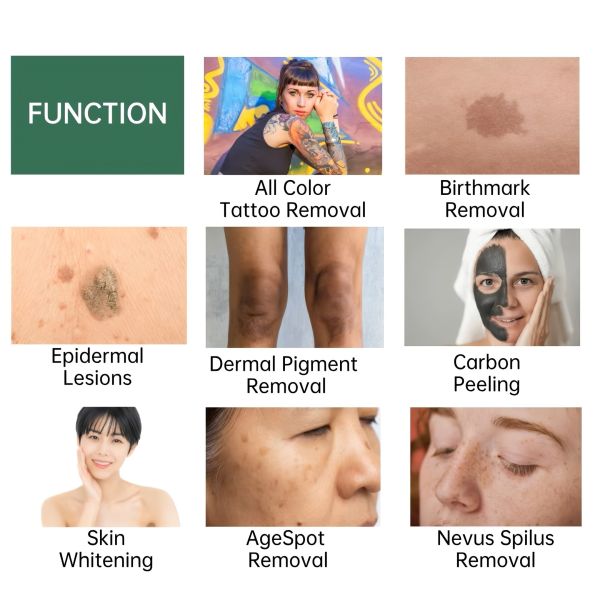 Non Invasive Pigment Removal Machine 3000W Facial Brightening Picosecond Laser Machine
