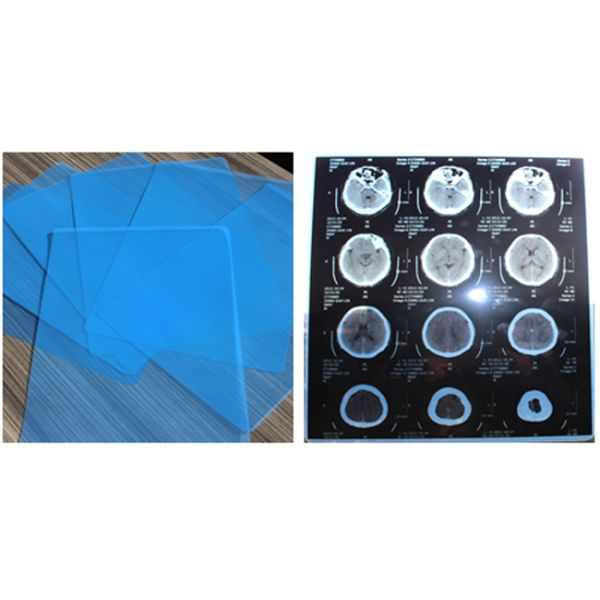 Фильм кс Рэй фильма медицинского отображения кс Рэй цифров голубой чувствительный для КТ МРИ