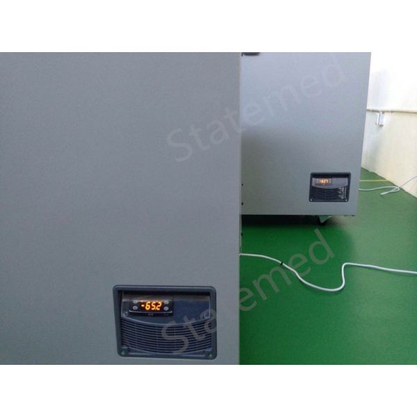 OEM -60 Degree Portable Chest Deep Freezer Medical Cryogenic Equipments