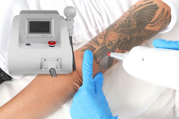 DPL Professional Q Switched Nd Yag 1064nm Carbon Peel Eyebrow Tattoo Removal Laser Machine