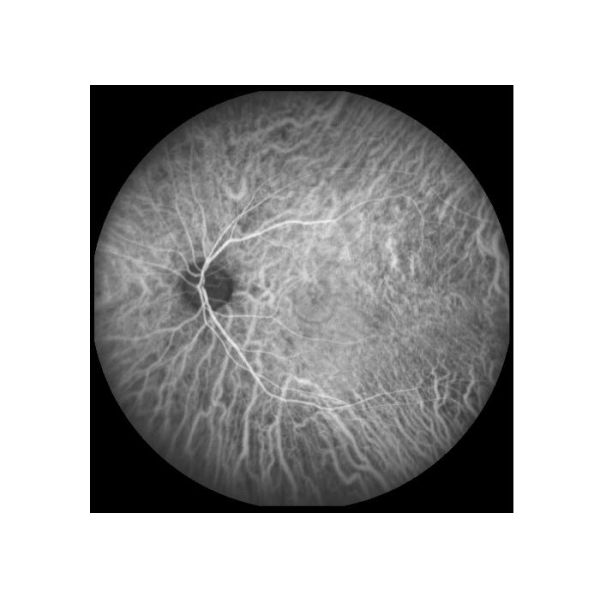 Equipo oftálmico de Angiograph Digital 160° de la retina