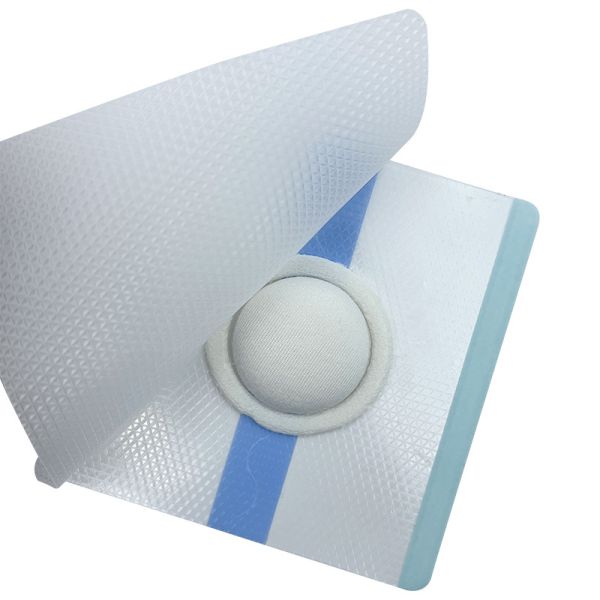 Skin Friendly Breathable Clear Wound Care Dressing For Baby'S Navel Neonatal Hip Hernia