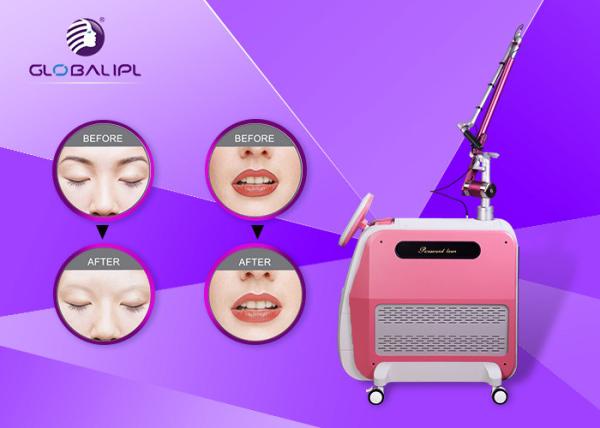 1064 / estilo do Portable da máquina da remoção da tatuagem do laser do Nd Yag do interruptor de 532nm Q