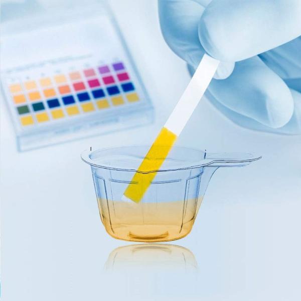 40ml Plastic Disposable Urine Cups - 80/120/200 Pcs Easy To Collect Urine Specimen Cups For Pregnancy Test/Ovulation