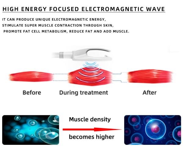 2 / 4/5 manijas RF Emslim Nova Machine EMShapeing Fat Burning
