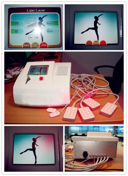 100mw diode light portable weight loss lipo laser slimming machine supplier