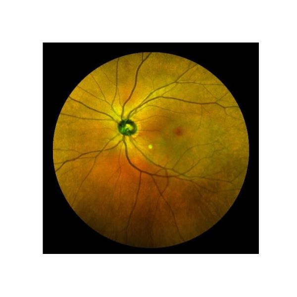 Equipo oftálmico de Angiograph Digital 160° de la retina