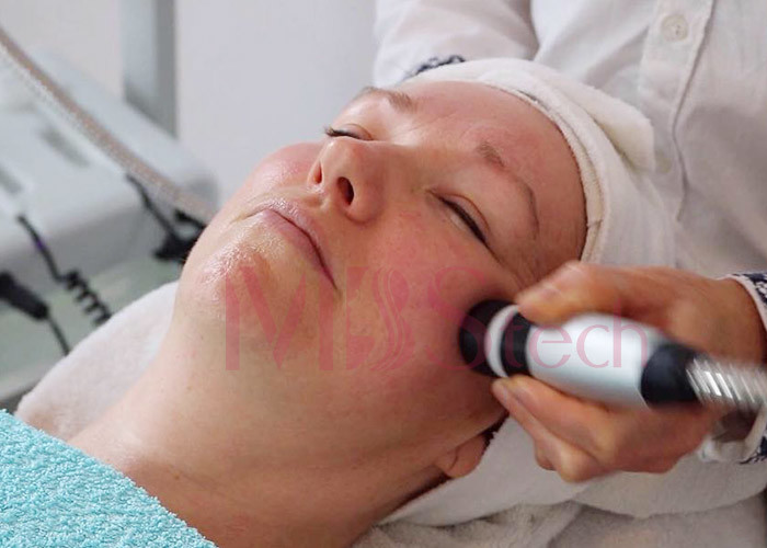 3 в 1 применять обложку к крутому холодному горячему Mesotherapy Cryo уменьшая машину