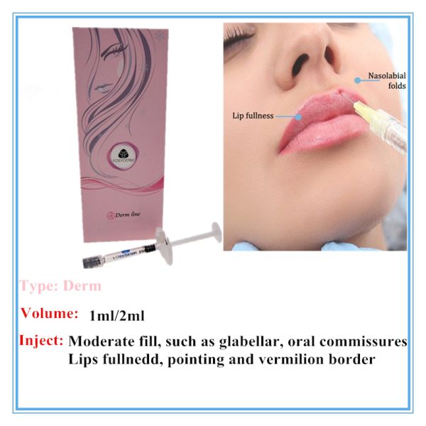 CE HA Dermal Filler Hyaluronic Acid Fosyderm 1ml Lip Injections