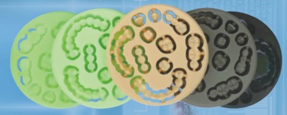 Yucera Dental Materials Pmma Dental Block Pen System for Beauty restoration High-performance