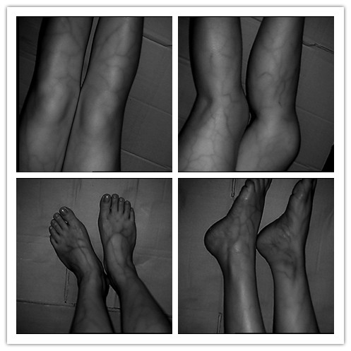 Испытательные оборудования ультракрасное VeinViewer крови для пользы больницы