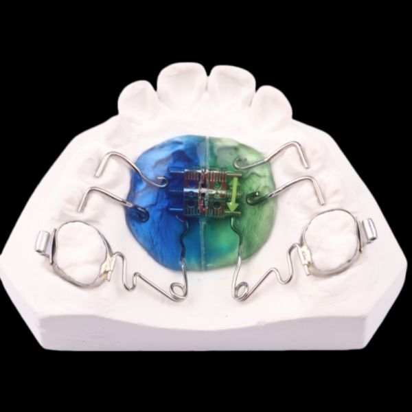 FDA Pendulum Appliance Orthodontics Pendulum Ortho Appliance Customizable