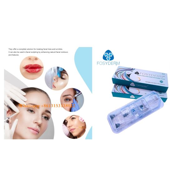 Заполнитель лицевого заполнителя геля Ha морщинки дермального вводимый Hyaluronic кисловочный для губ