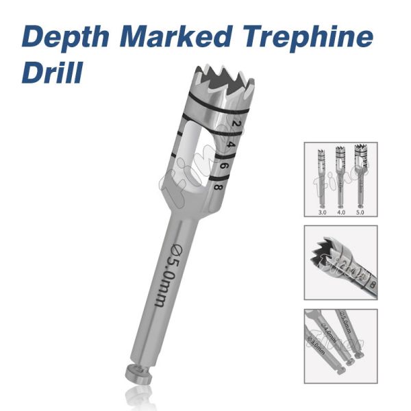 Cortador de tecidos moles Profundidade Marcada Trefina Furação Corte Implante Dental Furação Cirúrgica