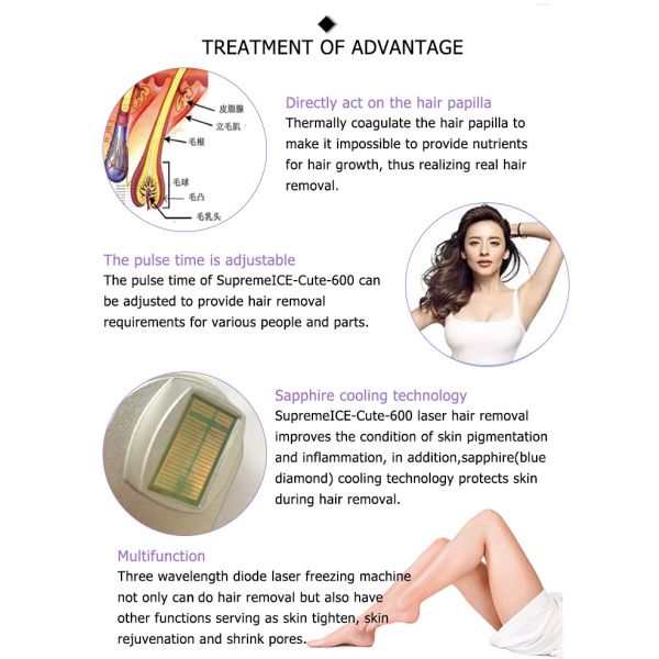 china Vertical high power new tri-wavelength depilacion equipment maquina de hair removal 810 808nm laser diodo
