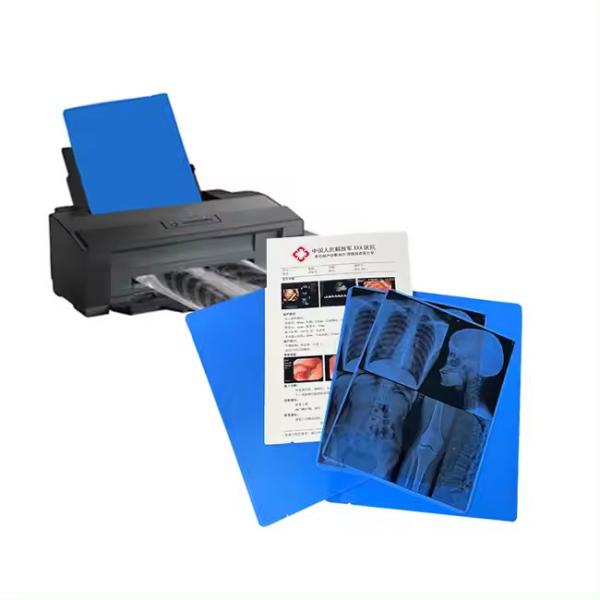 Le film bleu médical à rayons X pour l'impression au laser a une expérience