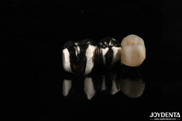 Abrasion Resistant Metal Alloy Crown For Customized Dental Restorations