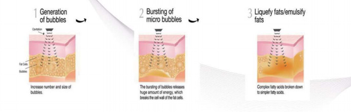 40KHz Body Slimming Machine Ultrasonic RF Vacuum Cavitation Machine