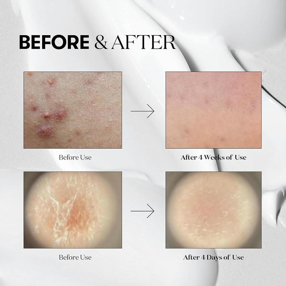 OEM ODM Korean brand natural skin care products Microneedle serum Centalla soothing repair skin care products Face essence