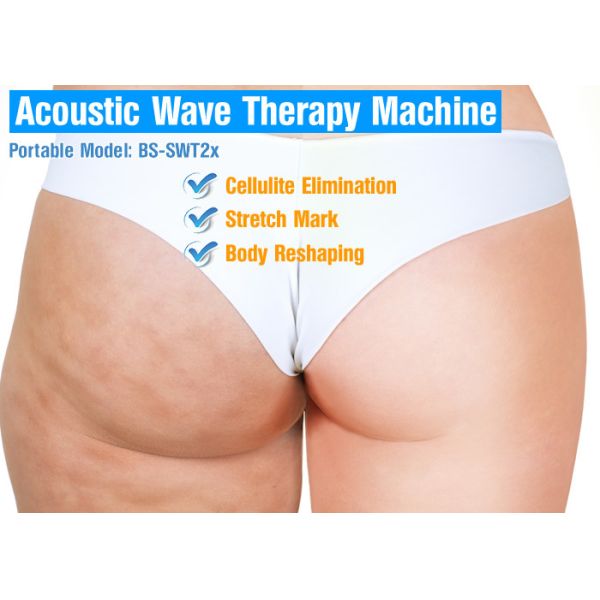 Терапия акустической волны красоты для источника Ген целлюлита 4рд магнитного электрического