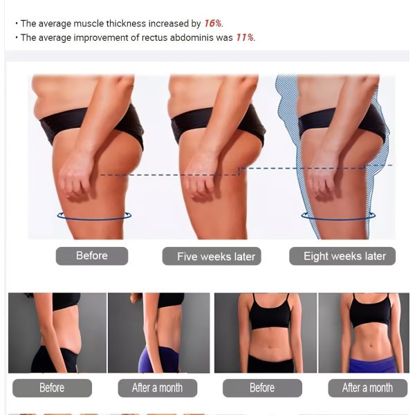 Radio Frequency Body Sculpting Machine Professional 13 Tesla EMS Slimming Machine