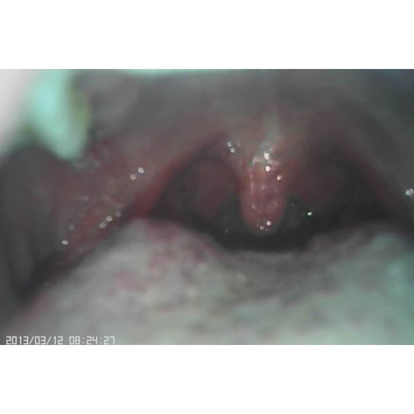 Набор диагностики Отоскопе офтальмоскопа Эндоскопе естественного Отоскопе белого света ЭНТ