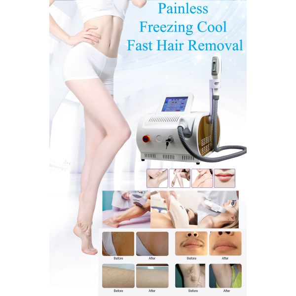 Professional Skin Tightening Hair Removal Machine IPL Opt Shr Ipl Hair Removal Machine