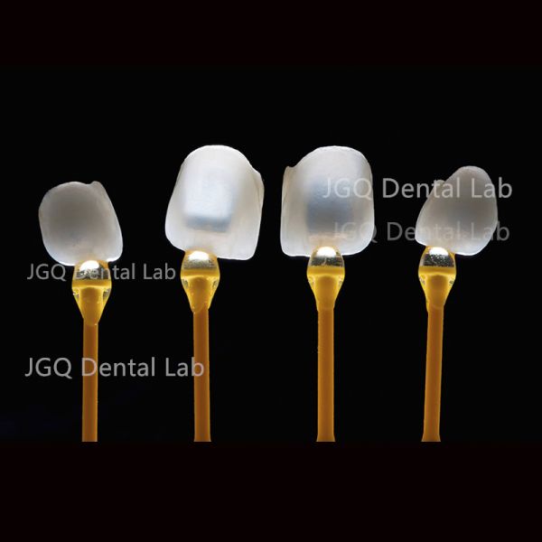 High Translucency Cast Porcelain Emax Veneers China Dental Lab OEM