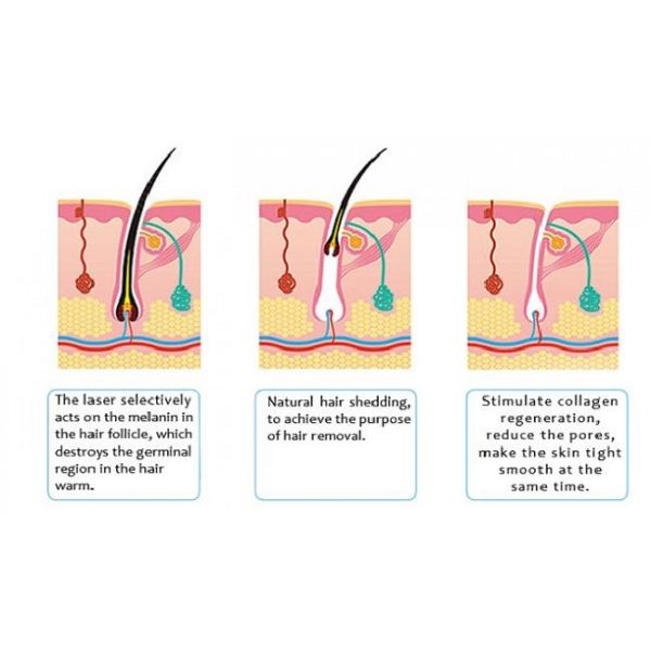 подмолаживание кожи постоянной машины удаления волос лазера 800W коммерчески