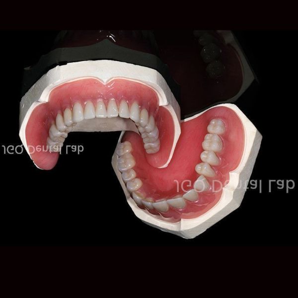 Natural Looking Removable Partial Dentures Customized for Daily Functions