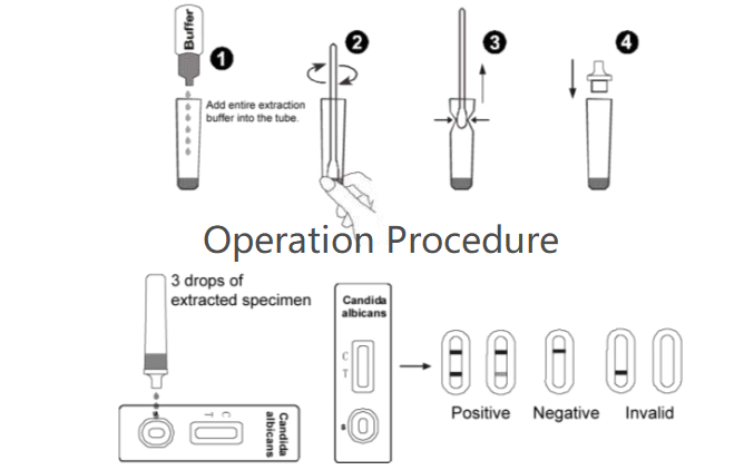 Candida Albicans Rapid Test Kit With Vaginal Swab Cassette Device Kit