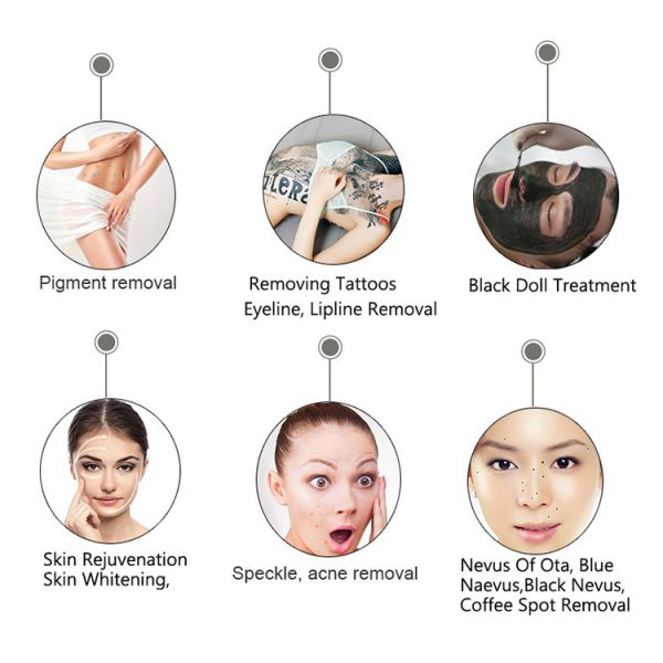 Машина лазера пикосекунды машины 755nm удаления волос 2000MJ DPL